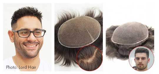 non-surgical hair replacement san diego california